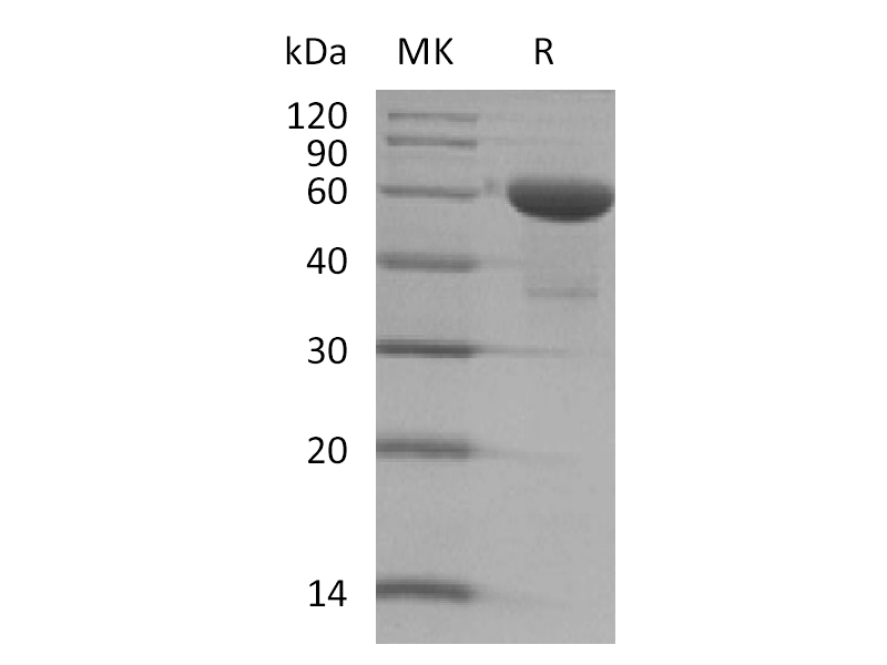 Recombinant Human TMED1 (C-Fc)