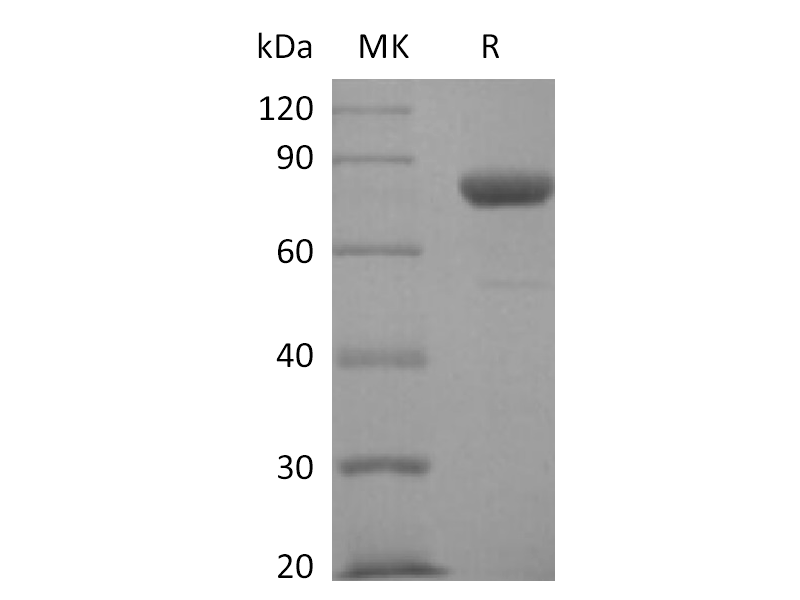 Recombinant Human Nectin-4 (C-Fc)
