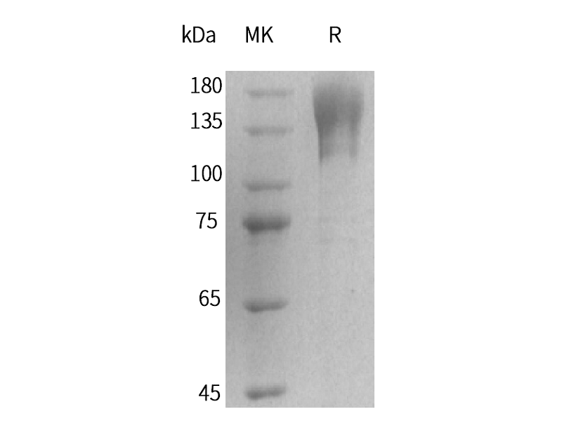 Recombinant Human CD96 (C-Fc)