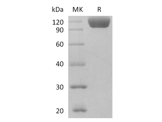 Recombinant Human Siglec-10 (C-Fc)