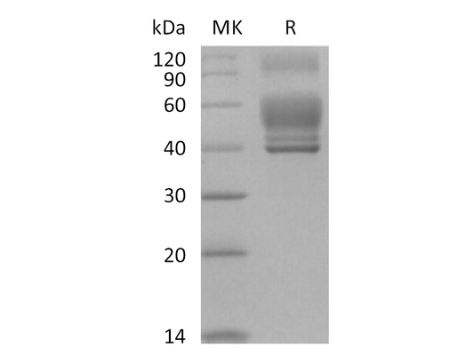 Recombinant Human IL-13 (C-Fc)