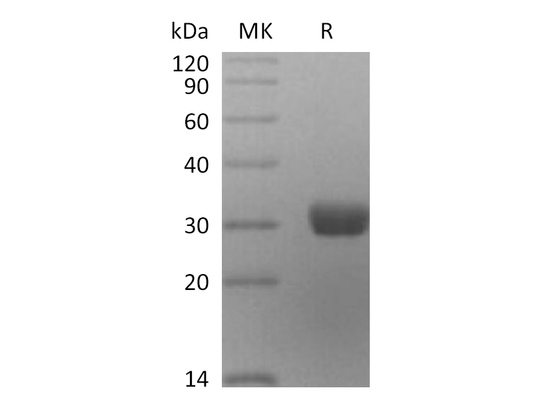 Recombinant Human ANG2 (C-6His)