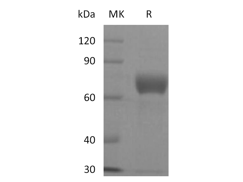 Recombinant Human TSLP R (C-Fc)