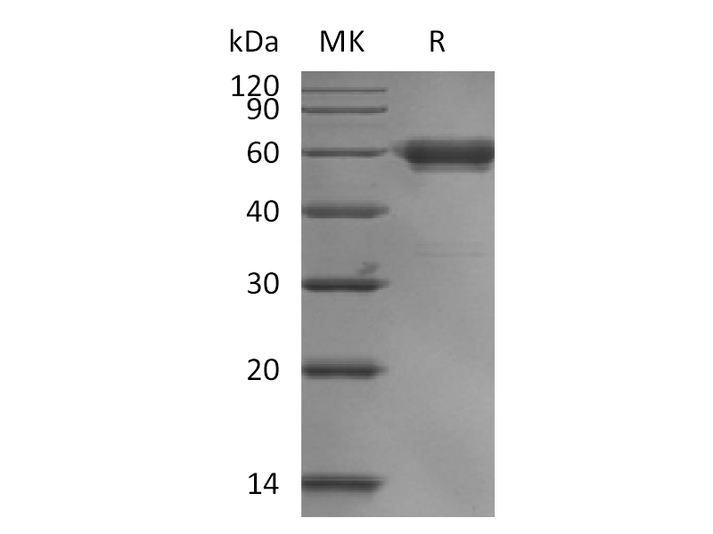 Recombinant Human LAIR1 (C-mFc)