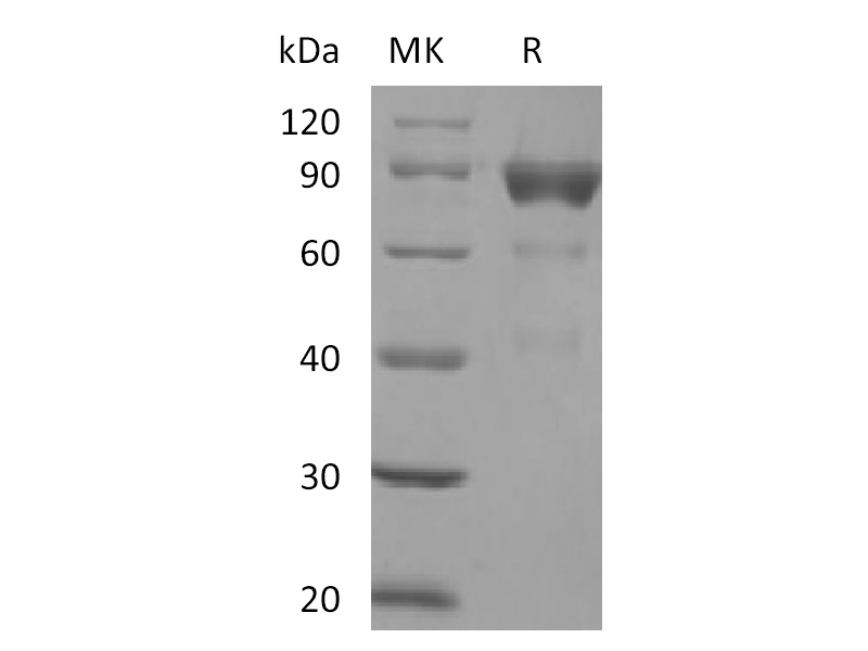 Recombinant Human SIRPB2 (C-Fc)