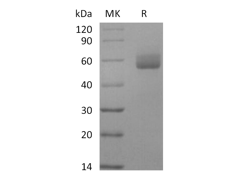 Recombinant Human GPIHBP1 (C-Fc)