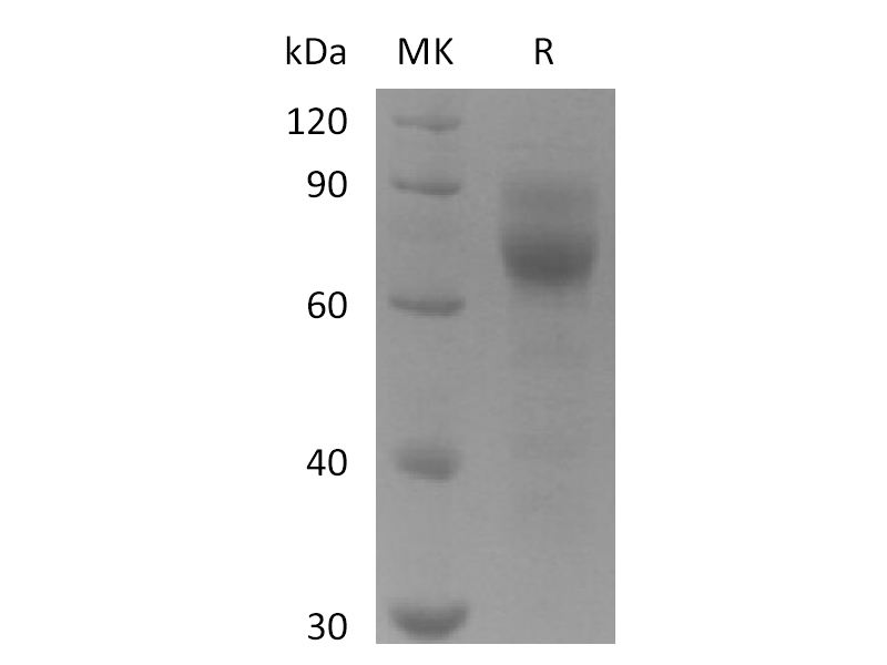 Recombinant Human AXL (C-6His)