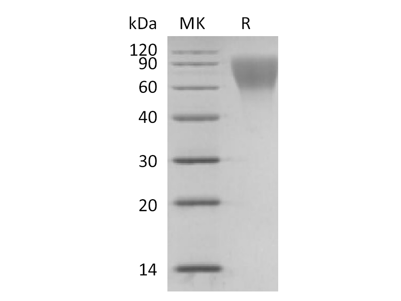 Recombinant Human CD34 (C-6His)