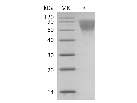Recombinant Human CD34 (C-6His)