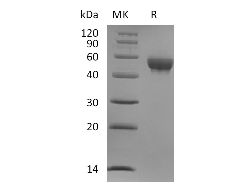 Recombinant Human Siglec-8 (C-6His)