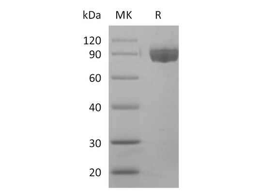 Recombinant Human Afamin (C-6His)