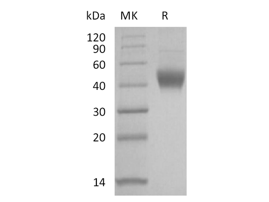 Recombinant Human IL-7RA (C-6His)