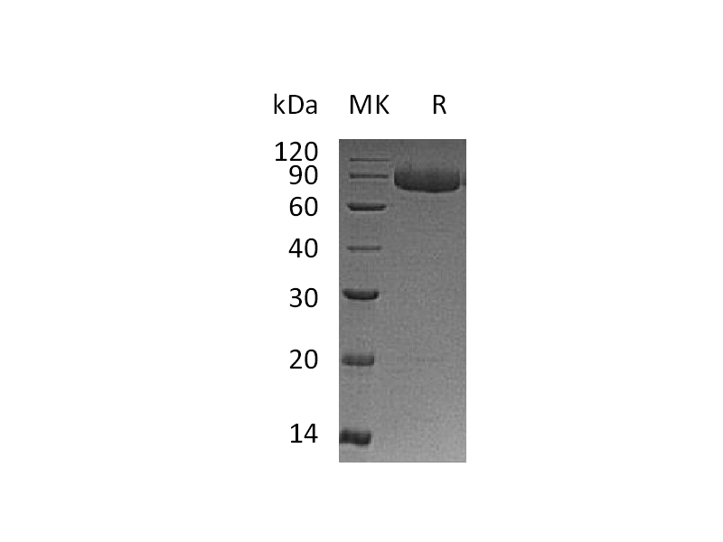Recombinant Human IL-12RB1 (C-6His)
