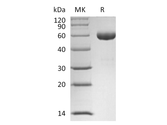 Recombinant Human ANG1 (N-Fc)