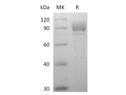 Recombinant Human Otolin-1 (C-6His)