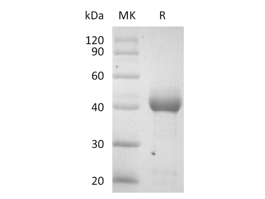 Recombinant Human ALK-2 (C-Fc)