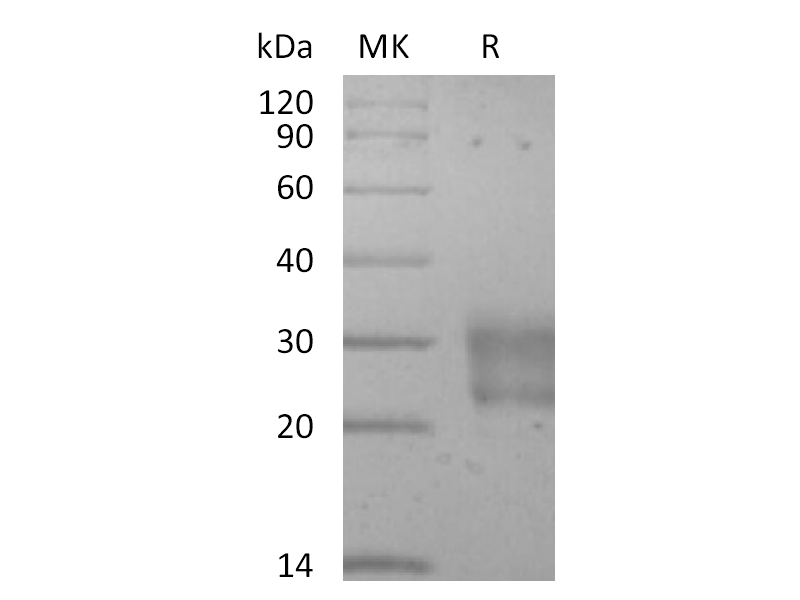 Recombinant Human Frizzled-8 (C-6His)