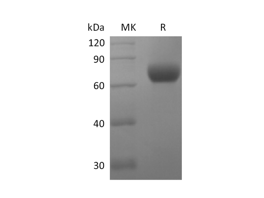 Recombinant Human CD244 (C-Fc)