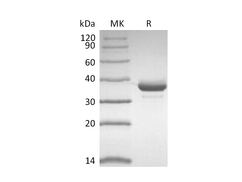 Recombinant Human CD81 (N-FC)