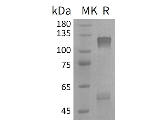 Recombinant Human IGF-I R (C-6His)