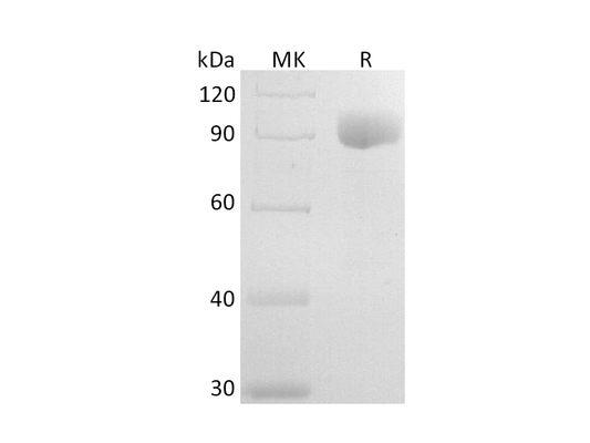 Recombinant Human IL-6RA (C-Fc)