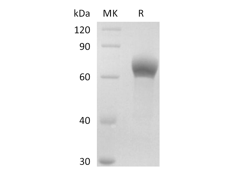 Recombinant Human DKK-1 (C-Fc)