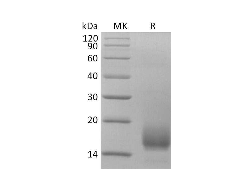 Recombinant Human CD59 (C-6His)