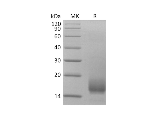 Recombinant Human CD59 (C-6His)