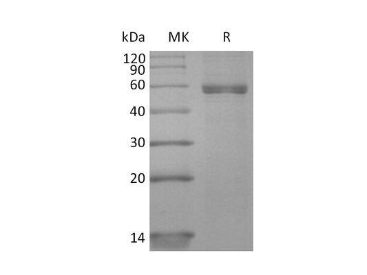 Recombinant Human HLA-A*0201 NY-ESO-1 complex Protein (C-10His)