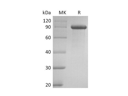 Recombinant Human DLL1 (C-Fc)