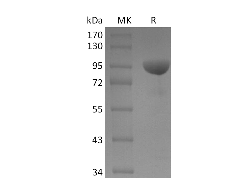 Recombinant Human EphB1 (C-Fc)