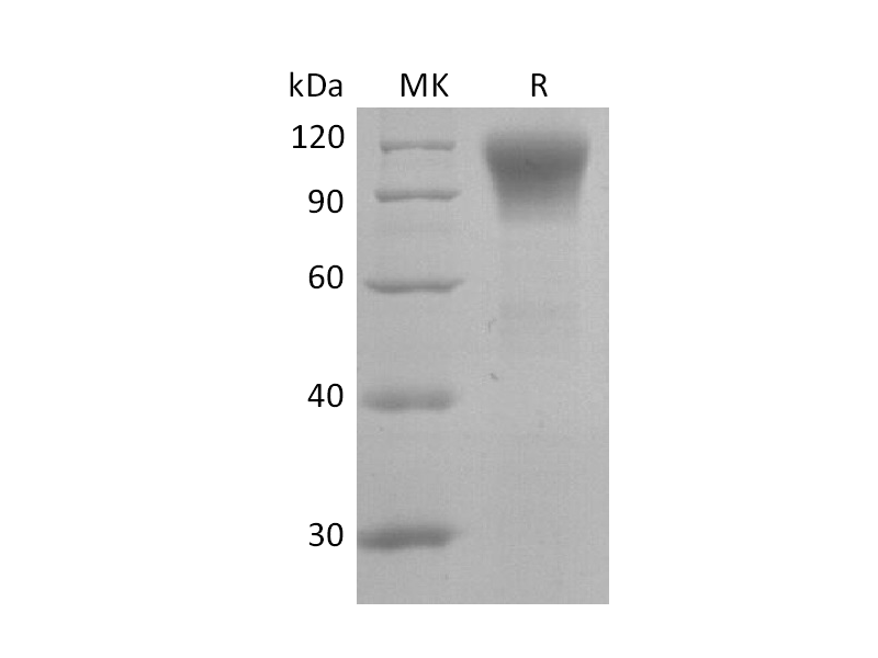 Recombinant Human CD45R0 (C-6His)