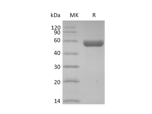 Recombinant Human HLA-A*0201 GP100 complex Protein (C-10His)