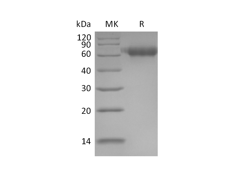Recombinant Human IL-1RAcP (C-6His)