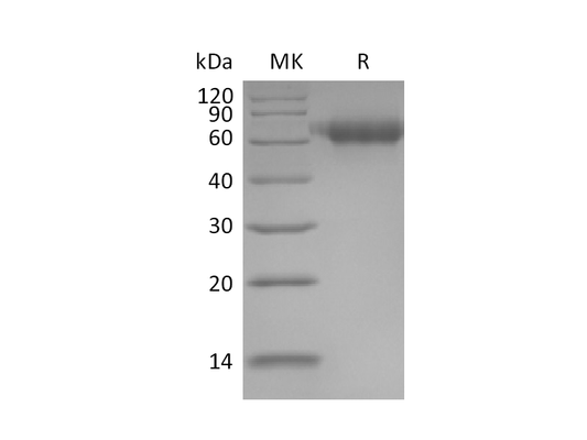 Recombinant Human IL-1RAcP (C-6His)