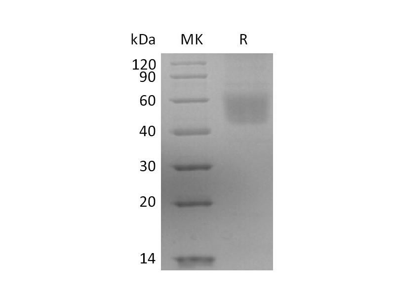 Recombinant Human IL-3RA (C-6His)