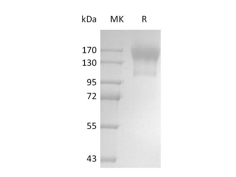 Recombinant Human CD45 (C-6His)