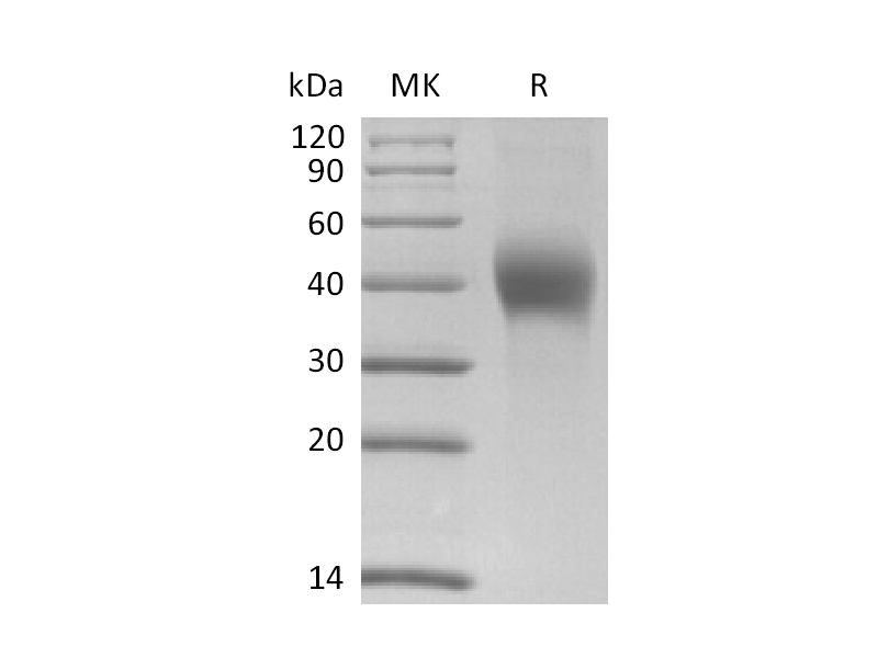 Recombinant Human DKK-1 (C-6His)