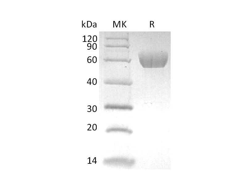 Recombinant Human MAdCAM-1 (C-6His)