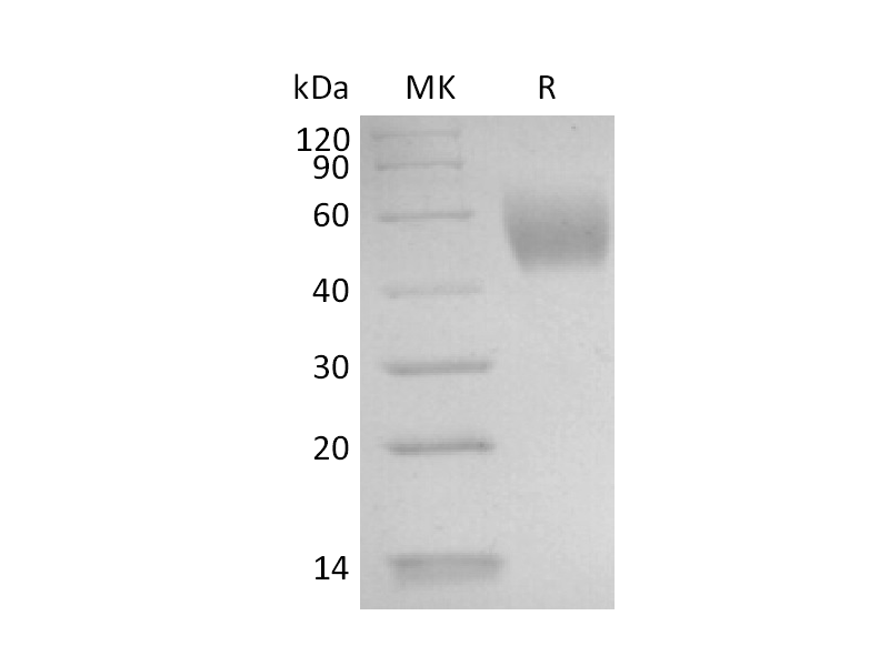Recombinant Human IL-17RD (C-6His)