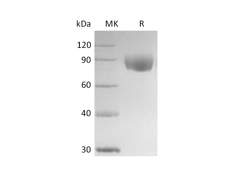 Recombinant Human IL-17RD (C-Fc)