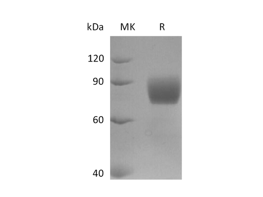 Recombinant Human FGFR2IIIb (C-Fc)