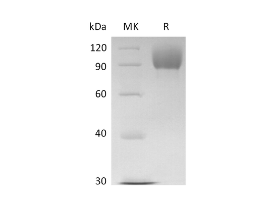 Recombinant Human FGFR2IIIb (357AA,C-Fc)