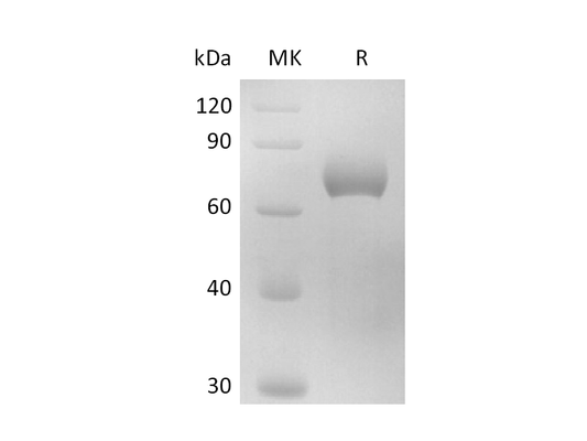 Recombinant Human IL-17RB (C-Fc)