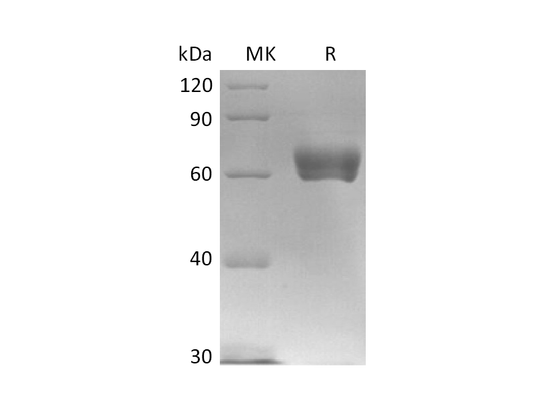 Recombinant Human IL-17RE (C-Fc)