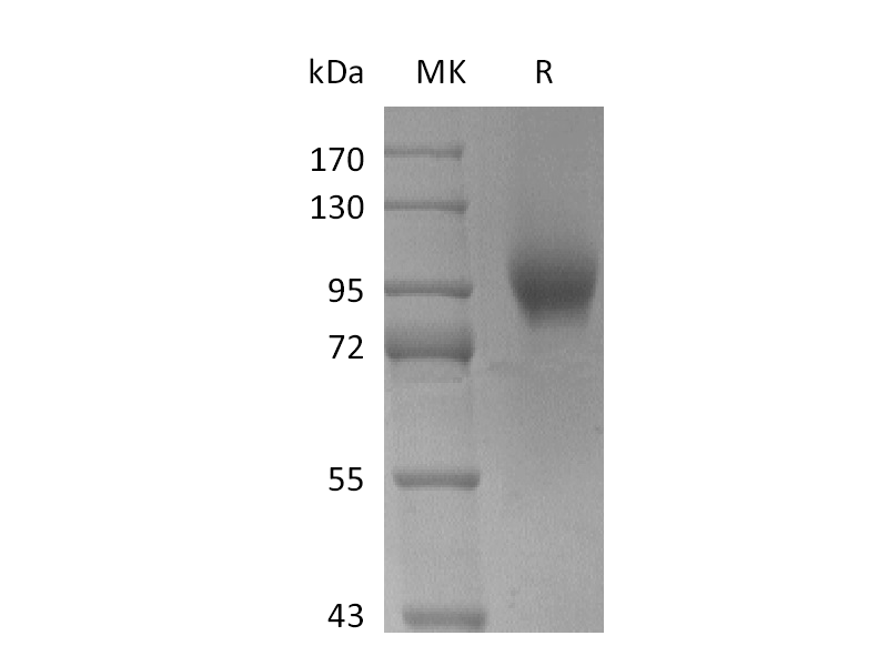 Recombinant Human AXL (C-Fc)