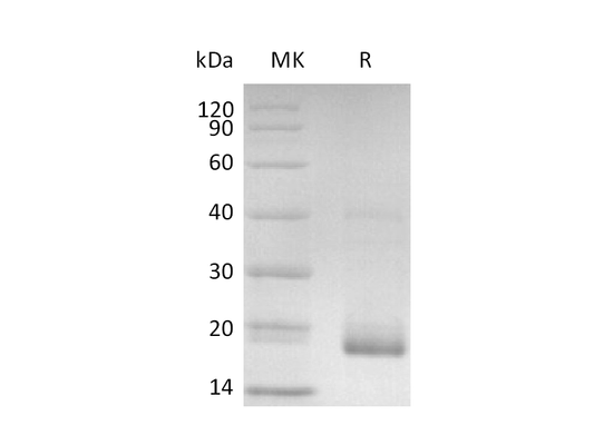 Recombinant Human IL-17C (C-6His)