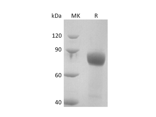 Recombinant Human IL-18RAcP (C-Fc-6His)