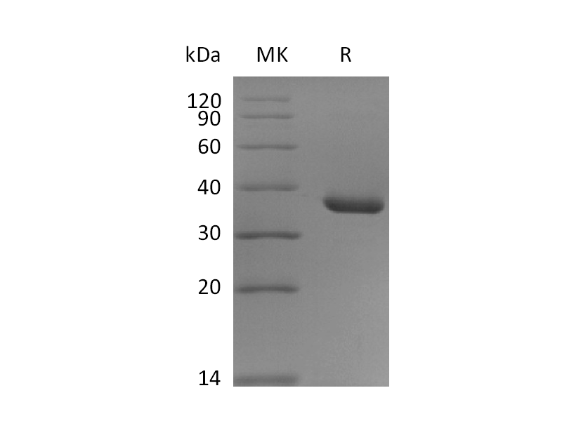 Recombinant Human CD9 (N-Fc)