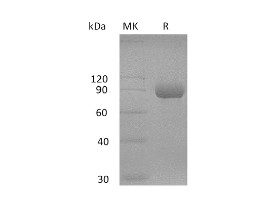 Recombinant Human MAdCAM-1 (C-Fc)